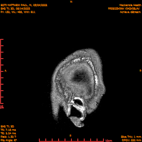 2025-06-14/SAG T1 3D/0153-IM338.png