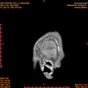 2025-06-14/SAG T1 3D/0154-IM339.png