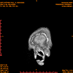 2025-06-14/SAG T1 3D/0155-IM340.png