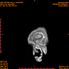 2025-06-14/SAG T1 3D/0156-IM341.png