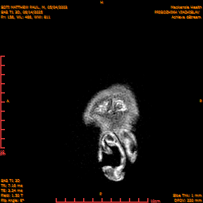 2025-06-14/SAG T1 3D/0157-IM342.png