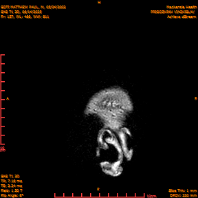 2025-06-14/SAG T1 3D/0158-IM343.png