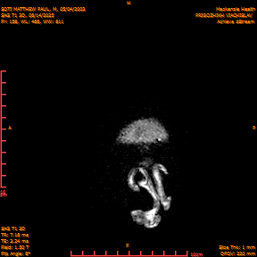 2025-06-14/SAG T1 3D/0159-IM344.png