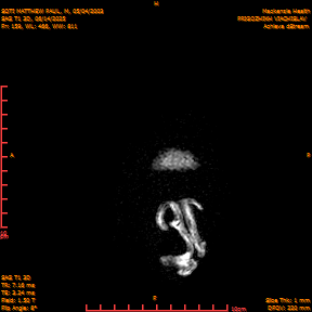 2025-06-14/SAG T1 3D/0160-IM345.png