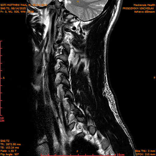 2025-06-14/SAG T2/0001-IM1048.png