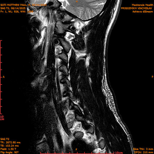 2025-06-14/SAG T2/0002-IM1049.png