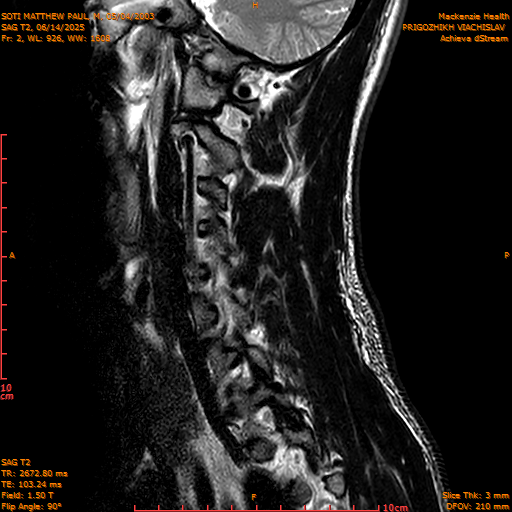 2025-06-14/SAG T2/0003-IM1050.png