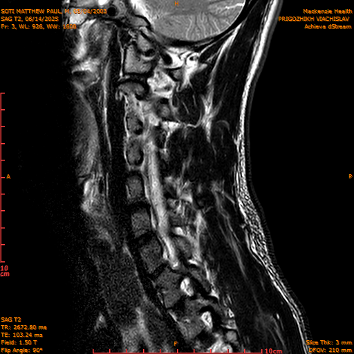 2025-06-14/SAG T2/0004-IM1051.png