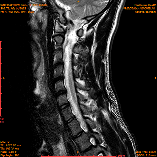 2025-06-14/SAG T2/0005-IM1052.png
