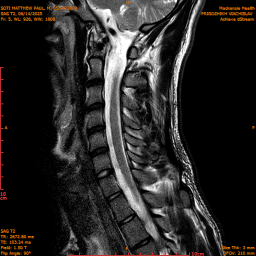 2025-06-14/SAG T2/0006-IM1053.png