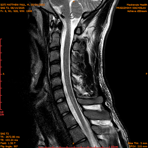 2025-06-14/SAG T2/0007-IM1054.png