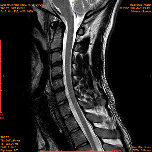2025-06-14/SAG T2/0008-IM1055.png