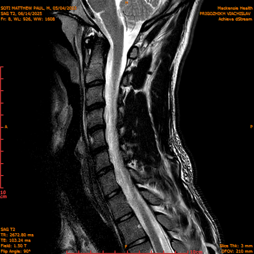 2025-06-14/SAG T2/0009-IM1056.png