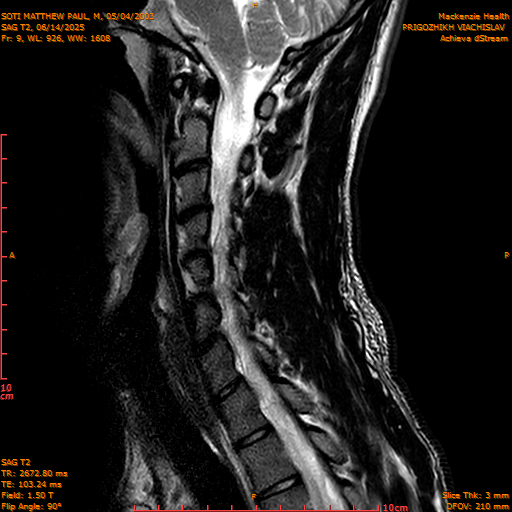 2025-06-14/SAG T2/0010-IM1057.png