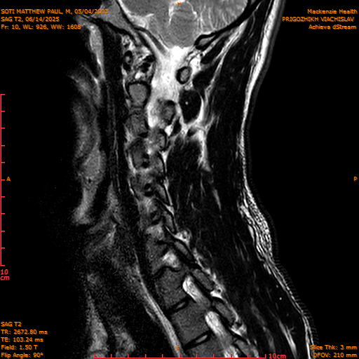 2025-06-14/SAG T2/0011-IM1058.png