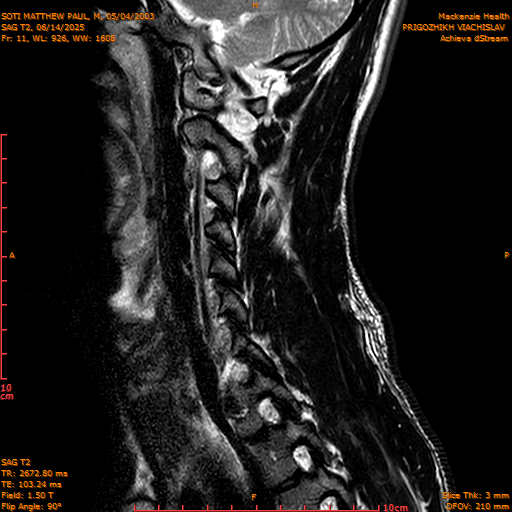 2025-06-14/SAG T2/0012-IM1059.png