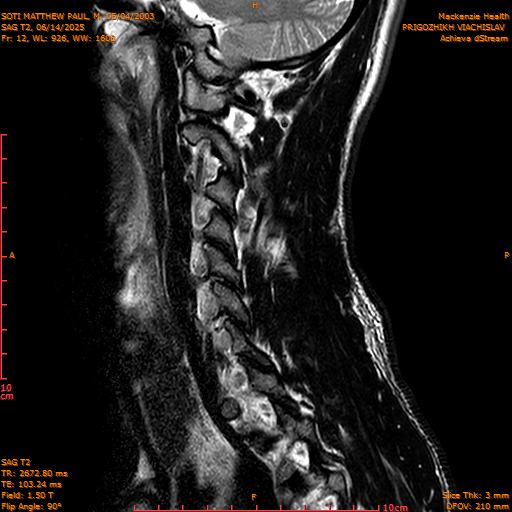 2025-06-14/SAG T2/0013-IM1060.png