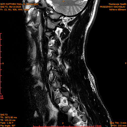 2025-06-14/SAG T2/0014-IM1061.png