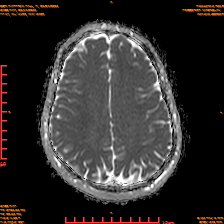 2025-06-14/dADC MAP/0018-IM931.png