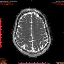 2025-06-14/dADC MAP/0020-IM933.png