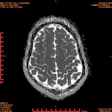 2025-06-14/dADC MAP/0021-IM934.png