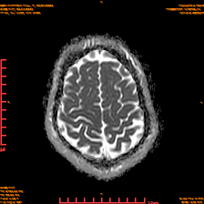 2025-06-14/dADC MAP/0022-IM935.png