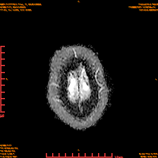 2025-06-14/dADC MAP/0025-IM938.png
