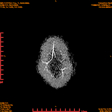 2025-06-14/dADC MAP/0026-IM939.png