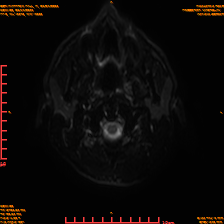 2025-06-14/sDWI B0/0001-IM966.png