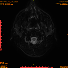 2025-06-14/sDWI B0/0002-IM967.png