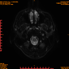 2025-06-14/sDWI B0/0003-IM968.png