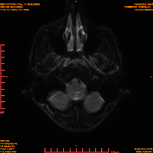 2025-06-14/sDWI B0/0004-IM969.png