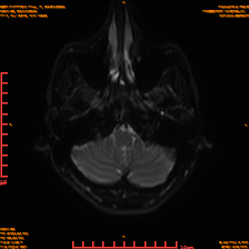 2025-06-14/sDWI B0/0005-IM970.png