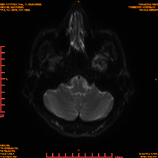2025-06-14/sDWI B0/0006-IM971.png