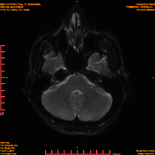 2025-06-14/sDWI B0/0007-IM972.png
