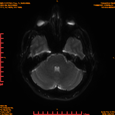 2025-06-14/sDWI B0/0008-IM973.png