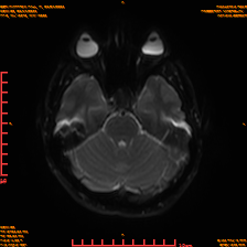 2025-06-14/sDWI B0/0009-IM974.png