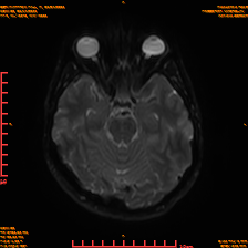 2025-06-14/sDWI B0/0010-IM975.png