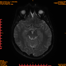 2025-06-14/sDWI B0/0011-IM976.png