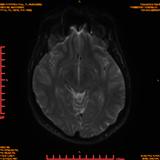 2025-06-14/sDWI B0/0012-IM977.png