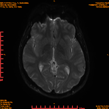 2025-06-14/sDWI B0/0013-IM978.png