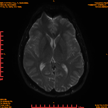 2025-06-14/sDWI B0/0014-IM979.png