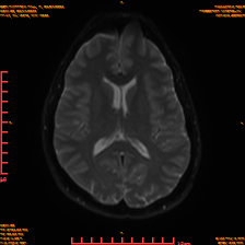 2025-06-14/sDWI B0/0015-IM980.png