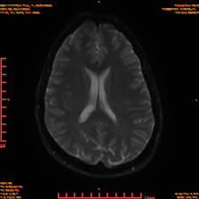 2025-06-14/sDWI B0/0016-IM981.png