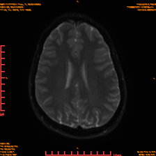 2025-06-14/sDWI B0/0017-IM982.png
