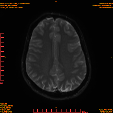 2025-06-14/sDWI B0/0018-IM983.png