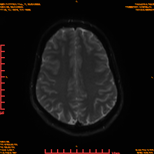 2025-06-14/sDWI B0/0019-IM984.png
