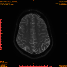 2025-06-14/sDWI B0/0020-IM985.png