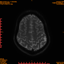 2025-06-14/sDWI B0/0021-IM986.png