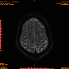 2025-06-14/sDWI B0/0022-IM987.png
